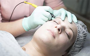 Electrolysis vs. Intense Pulsed Light (IPL) Hair Removal