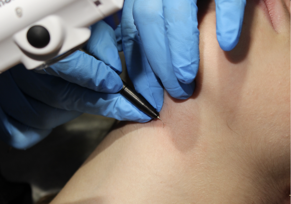 Nutrients for glowing skin