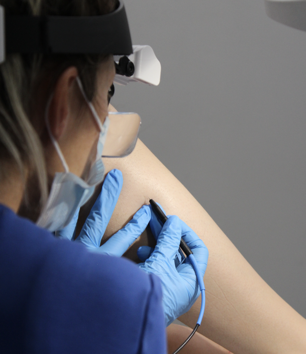 5 Electrolysis Hair Removal Side Effects